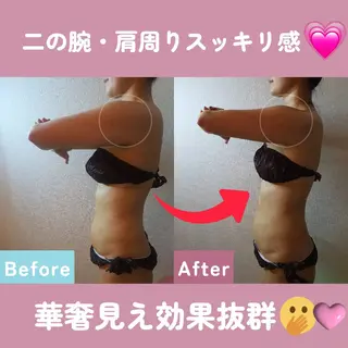 痩身ハーブピーリング 筋膜リリース☆B&Hのエステ・リラクイメージ