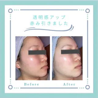 フェイシャルエステLe・Ciel所属・Le・Ciel フェイシャル&ボディのエステ・リラクイメージ