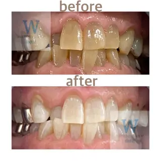 ホワイトニング ショップ船橋２号店のエステ・リラクイメージ