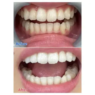 M渋谷店所属・Ｍ渋谷 ホワイトニングのその他イメージ