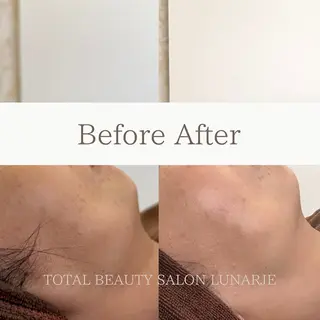 LUNARJE YUKARIのエステ・リラクイメージ