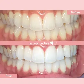 セルフホワイトニング エクシア札幌琴似店のその他イメージ