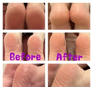 Relative ララティブのエステ・リラクイメージ