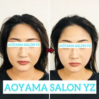 小顔美容鍼専門サロン 渋谷YZのエステ・リラクイメージ