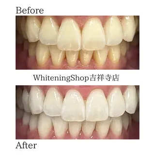 ホワイトニング ショップ吉祥寺店のエステ・リラクイメージ