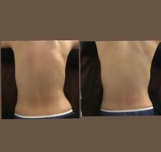 BESTUP 岐阜店のエステ・リラクイメージ