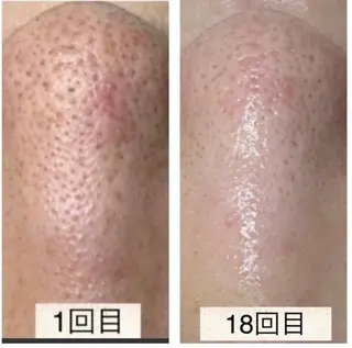 Eriedda所属・松下 千恵のネイルデザイン