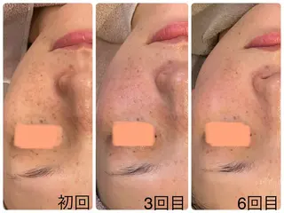 Hisui 小出のエステ・リラクイメージ