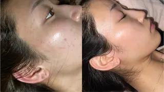 Amaranth所属・Lupinus 小顔矯正のエステ・リラクイメージ