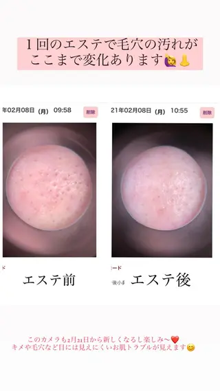 Luce所属・Luce Shokoのエステ・リラクイメージ