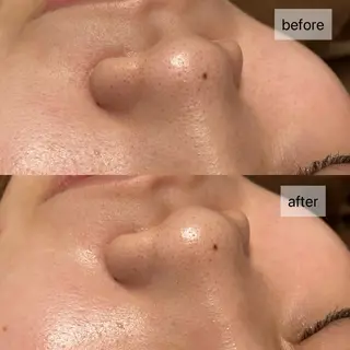 HINANO矢場町店【ヒナノ】所属・脱毛/肌改善🌿 HINANO 村田のエステ・リラクイメージ