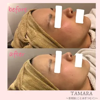 TAMARA 松下のエステ・リラクイメージ