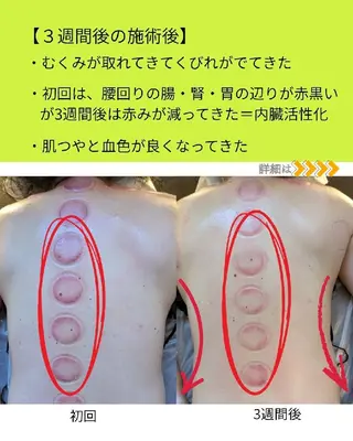 カッサ・カッピング専門サロン 水玉屋−suidamaya−所属・カッサ・カッピング 専門サロン/水玉屋のエステ・リラクイメージ