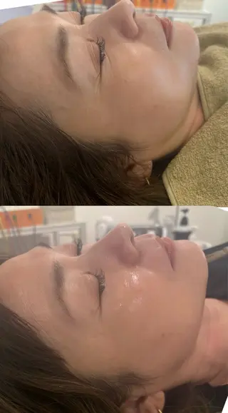 美容鍼灸サロン mahoroba院長のエステ・リラクイメージ