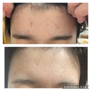 肌質改善🕊️ hirokoのエステ・リラクイメージ