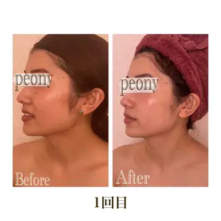 デトックス美容専門サロンｐｅｏｎｙ所属・デトックス美容専門 サロンｐｅｏｎｙのエステ・リラクイメージ