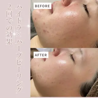 プライベートサロン Belle（ベル）のエステ・リラクイメージ