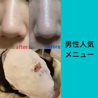 メンズ vio la〜ヴィオラ〜所属・エステティシャン ちえりのエステ・リラクイメージ