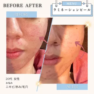 美白/韓国肌管理 💎 KOTOMIのエステ・リラクイメージ