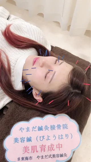 やまだ鍼灸接骨院（やまだしんきゅうせっこついん）所属・山田 晃のエステ・リラクイメージ