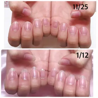 ネイル 深爪を断らない スカルプ高評価店のネイルデザイン