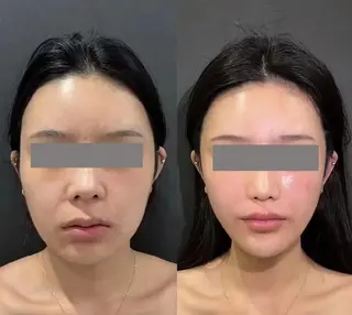 マツエク・マツパ aliaハイフ&水光ジェットサロン所属・aliaハーブ水光店 エステティシャン募集のエステ・リラクイメージ