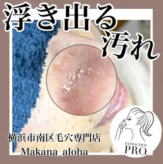 Makana_aloha所属・毛穴専門店 マカナアロハのエステ・リラクイメージ