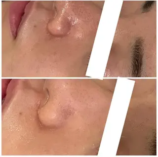 皮膚科で治らない肌へ lアクール 池袋店のエステ・リラクイメージ