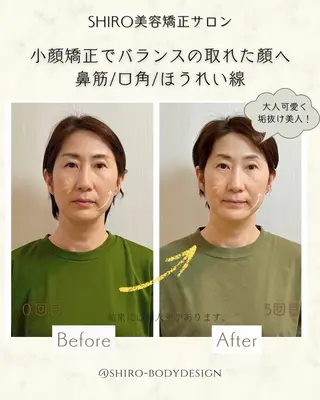 小顔美容矯正勝山式 shiroしろのエステ・リラクイメージ