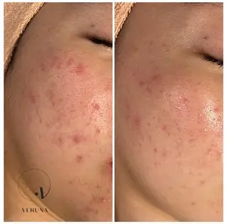 Grandir所属・ハーブピーリング専門 グランディール　武内のエステ・リラクイメージ