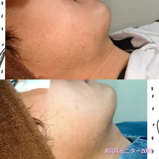 メンズ 武 藤のエステ・リラクイメージ