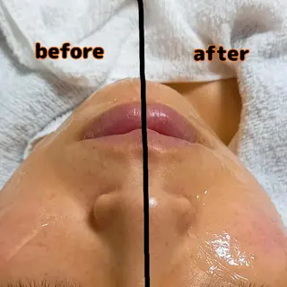 ナリスビューティーステーションDe I'm岡山所属・小野 恵のエステ・リラクイメージ