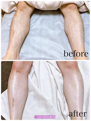 【痩身・脱毛サロン】 REBISKIN🌱のエステ・リラクイメージ