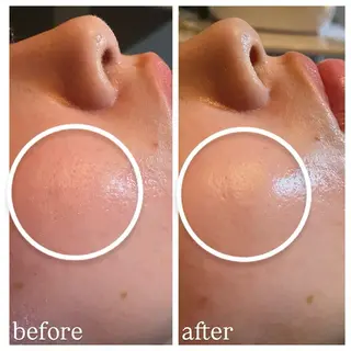 肌質改善専門 ハーブ /毛穴洗浄 リエイトのエステ・リラクイメージ