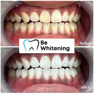 ホワイトニングサロン BE WHITE金山のその他イメージ