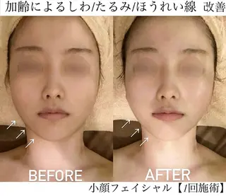 サロンハート浦和店所属・痩身小顔サロンハート 浦和店のエステ・リラクイメージ