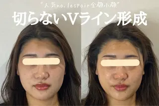 最速小顔・肌質管理 espoirマキのエステ・リラクイメージ