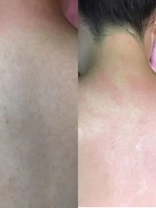 Puni 〜プーニー〜のエステ・リラクイメージ