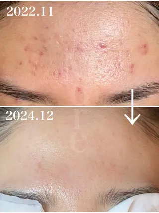 salon de beauté More所属・More 大阪福島区 毛穴・肌質改善のエステ・リラクイメージ