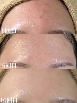 WHITE AQUA 北千住店のエステ・リラクイメージ