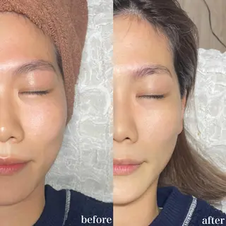 mieux所属・ハーブピーリング ¥6600のエステ・リラクイメージ