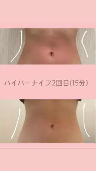 OPREA 栄店のエステ・リラクイメージ