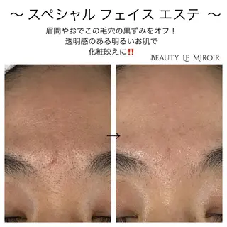 マツエク・マツパ ビューティー ミロワールのエステ・リラクイメージ