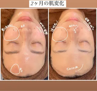 パーソナル肌質改善 🦋APRI🅿️有のエステ・リラクイメージ