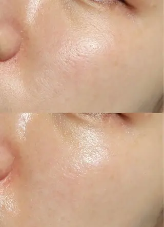 mire（ミレ） トータルビューティーのエステ・リラクイメージ