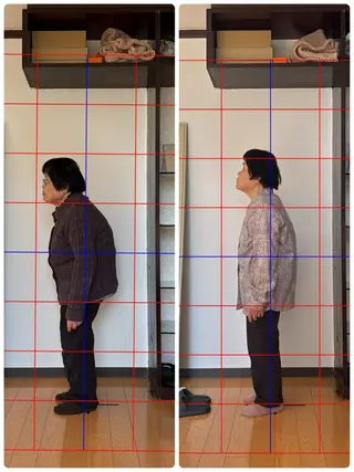 KAKERU 鍼灸整体【慢性痛】のエステ・リラクイメージ