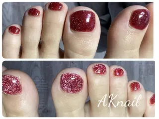 ネイル ネイル&巻き爪サロン 　AKnailのネイルデザイン