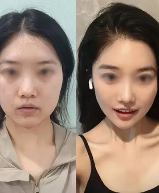 マツエク・マツパ aliaハイフ&水光ジェットサロン所属・aliaハーブ水光店 エステティシャン募集のエステ・リラクイメージ