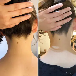 うなじ脱毛/美肌脱毛 LABELのエステ・リラクイメージ