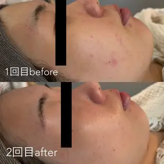 エステティックサロン Liente(リアンテ)所属・Hashimoto .のエステ・リラクイメージ